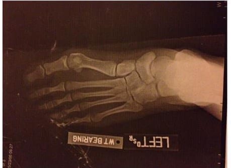 xray